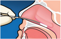 nasopharyngeal diagram