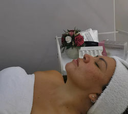 Limpieza facial