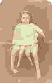 Myrtle Corbin was a 'dipygus', meaning she had two pelvises