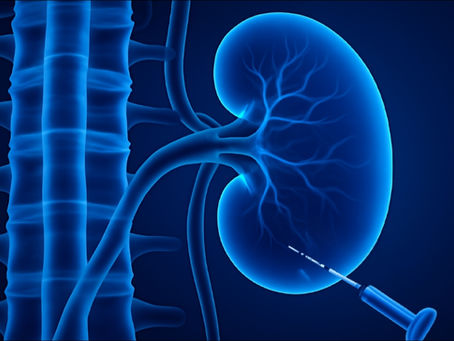 Interventional nephrology