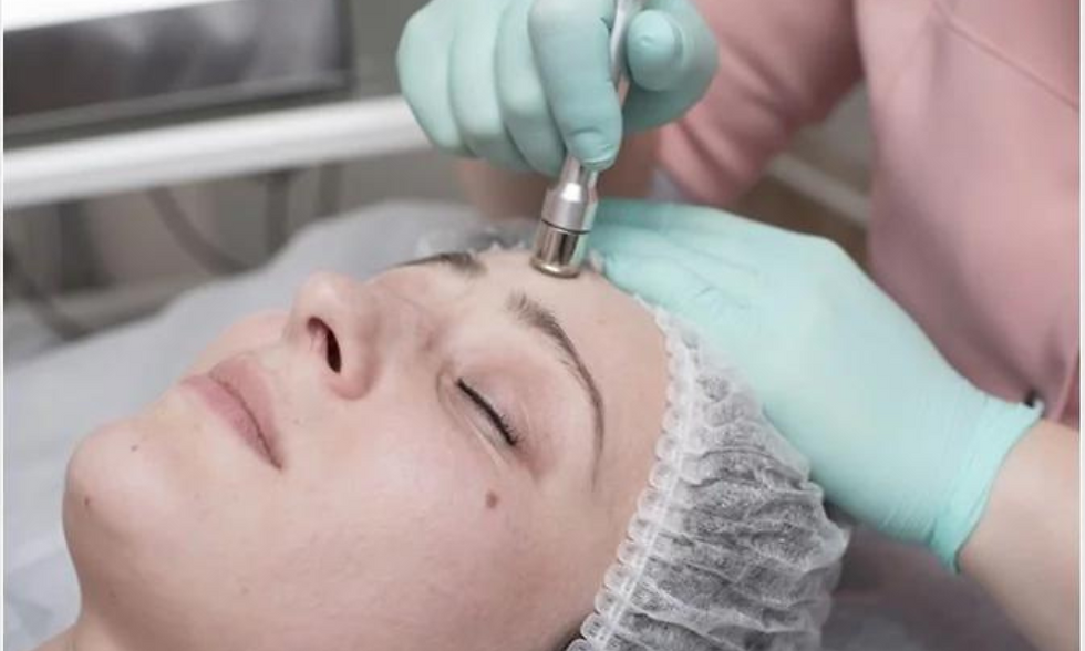 Dermabrasion