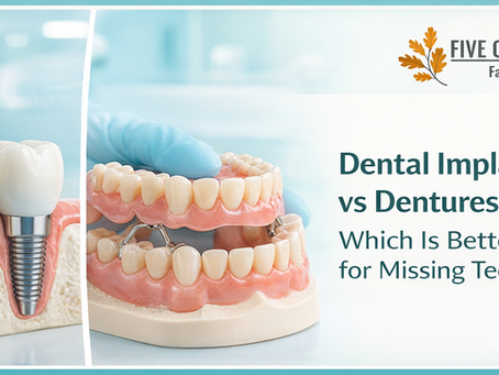 Dental Implants vs Dentures: Which Is Better for Missing Teeth?