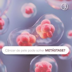Câncer de pele pode sofrer metástase?