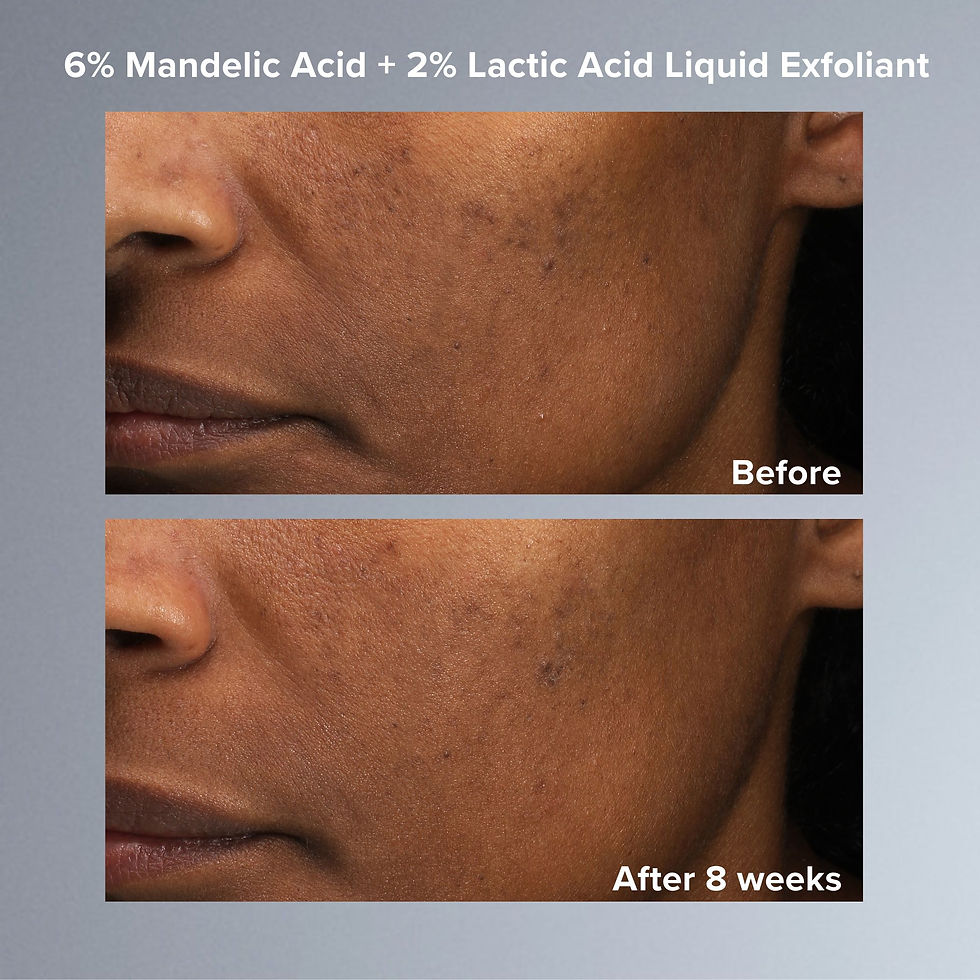 Thumbnail: Paula’s Choice 6% Mandelic Acid + 2% Lactic Acid Liquid Exfoliant