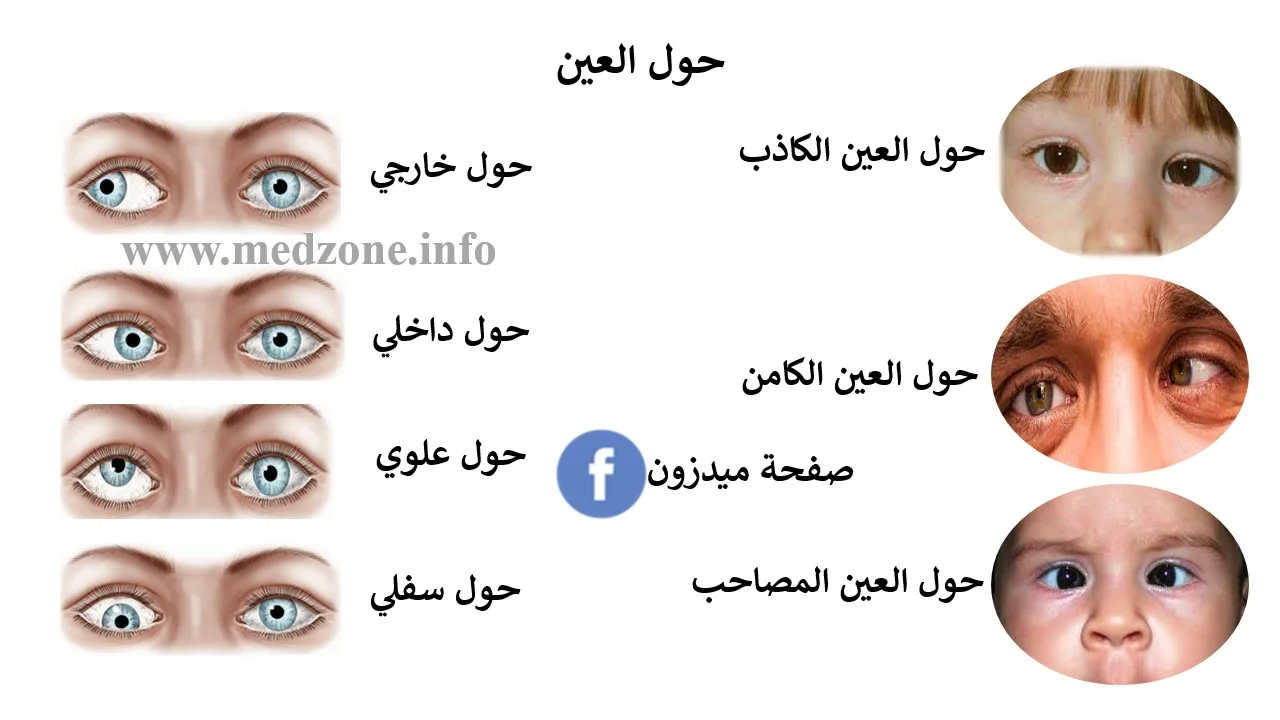 حول العين