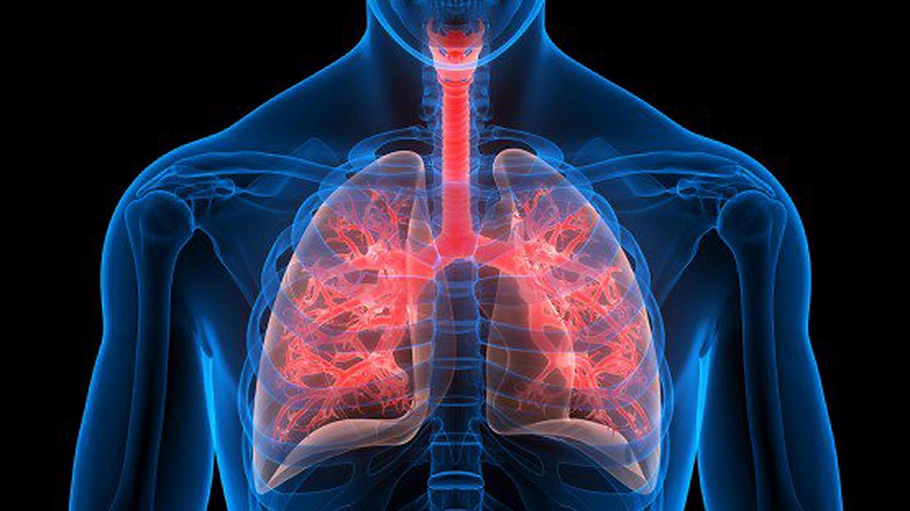 التهاب الشعب الهوائية انواع اسباب اعراض علاج ومضاعفات Medzone