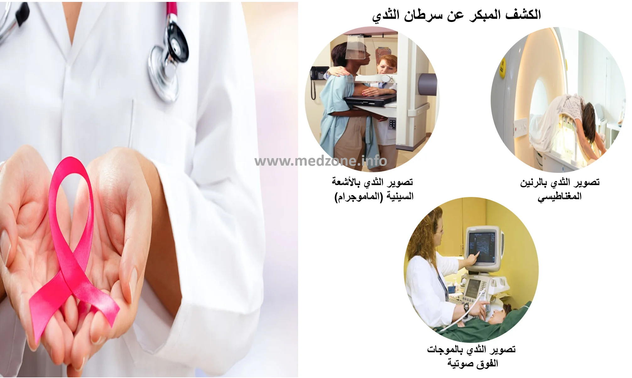 الكشف المبكر عن سرطان الثدي