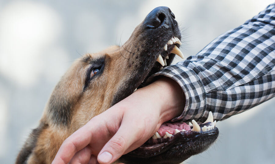 How to Handle Dog Bite Injuries