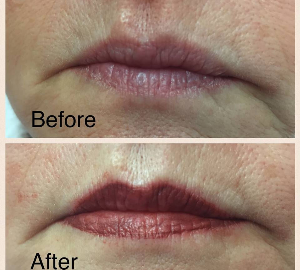 Lips
