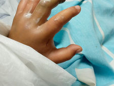 Desinformación, falta de médicos y escasez de suero.