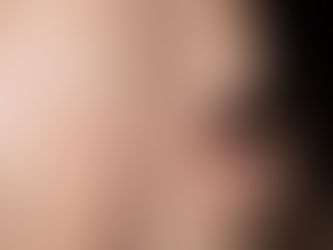 Kwas azelainowy na trądzik – jak stosować, żeby nie podrażnić skóry