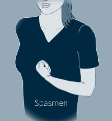 Moderne Therapie des spastischen Syndroms