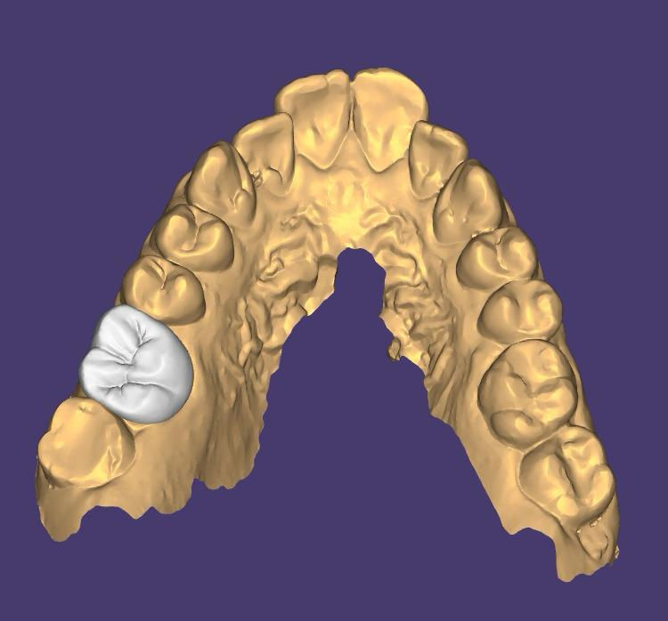 eliedental-cas5-cfao-conception-01.jpg