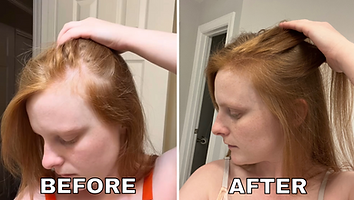 HAIR BEFOREAFTERS - 15.PNG