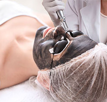 Spectra-Hollywood-Laser-Peel.jpg