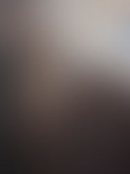 Η διάσωση ενός κακοποιημένου αλόγου - Rescue of malnourished horse