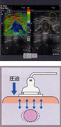 超音波の仕組み