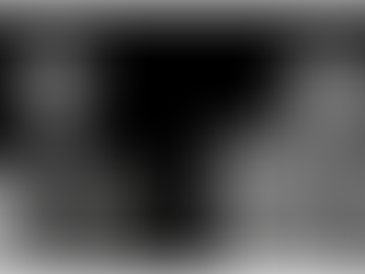 The Curious Case Files: Fibrodysplasia Ossificans Progressiva (FOP)