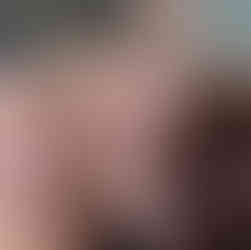 Deep tissue massage technique applied to neck and suboccipital muscles