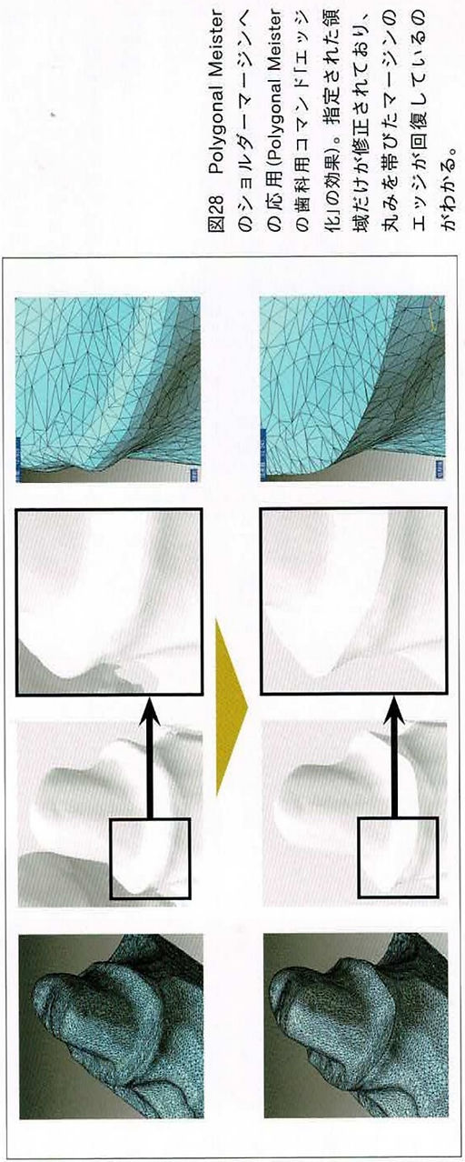 歯科技工 参考画像キセノンランプ動作良好 医科歯科技研 藤原社長の論文を