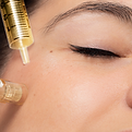 64b91ef8f8ad718e4d338087_microneedling-with-prp_edited.png