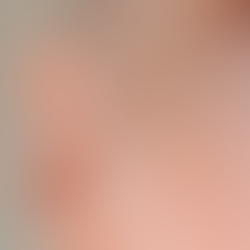 Isso é pinta ou verruga?