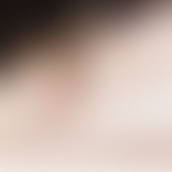 Como os pernilongos nos acham?