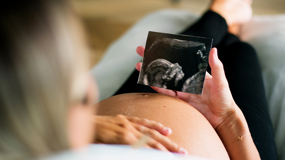 Pregnant women looking at the ultrasound of her baby.