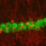 tdTom filled TRAP neurons