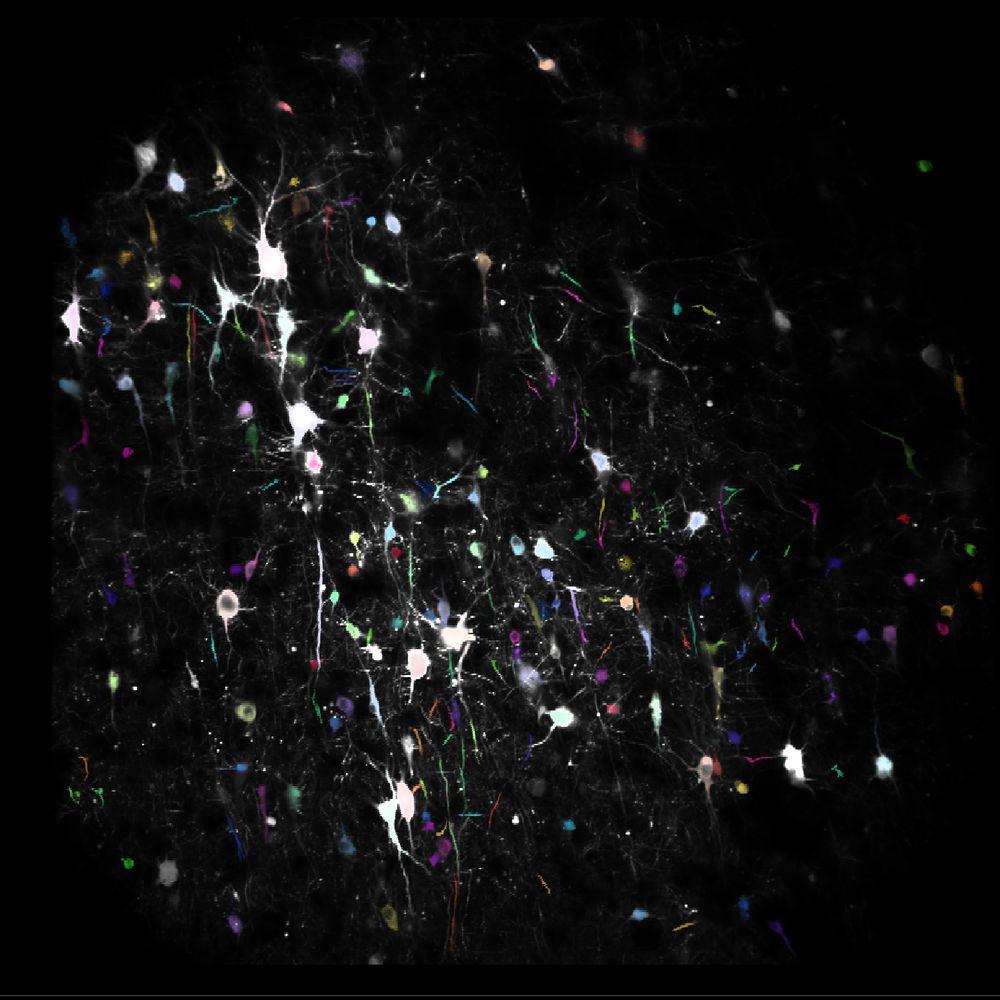 Fluorescently labeled neurons in a living slice of human cortex
