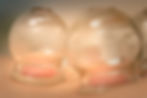 SerasanTCM_Schroepfen_MelanieMeadowcroft.jpg