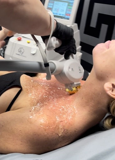 IPL being administered