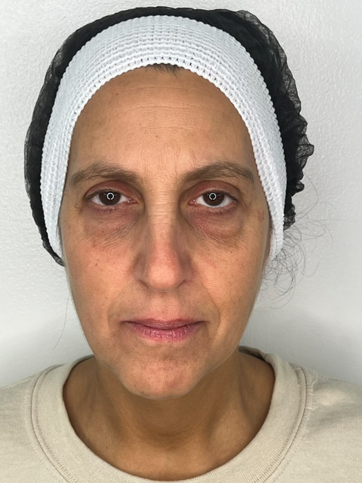 Before Microblading