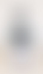 Hair Transplants for Men: What You Need to Know (Benefits, Process, Risks & Real Results)