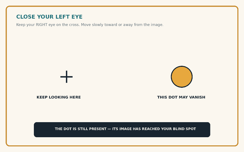 Blind-spot test: a black fixation cross on the left and a gold dot on the right, with instructions to close the left eye and fixate the cross using the right eye.