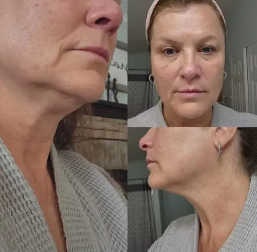 Thumbnail: Lymphatic Contour Face Brush — Depuffing & Sculpting Tool