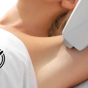 Epilazione Laser: Quanto Tempo per Completare il Ciclo di Trattamenti? Il Percorso verso una Pelle Liscia