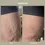 Thumbnail: ADIPEAU Strong Body Gel 