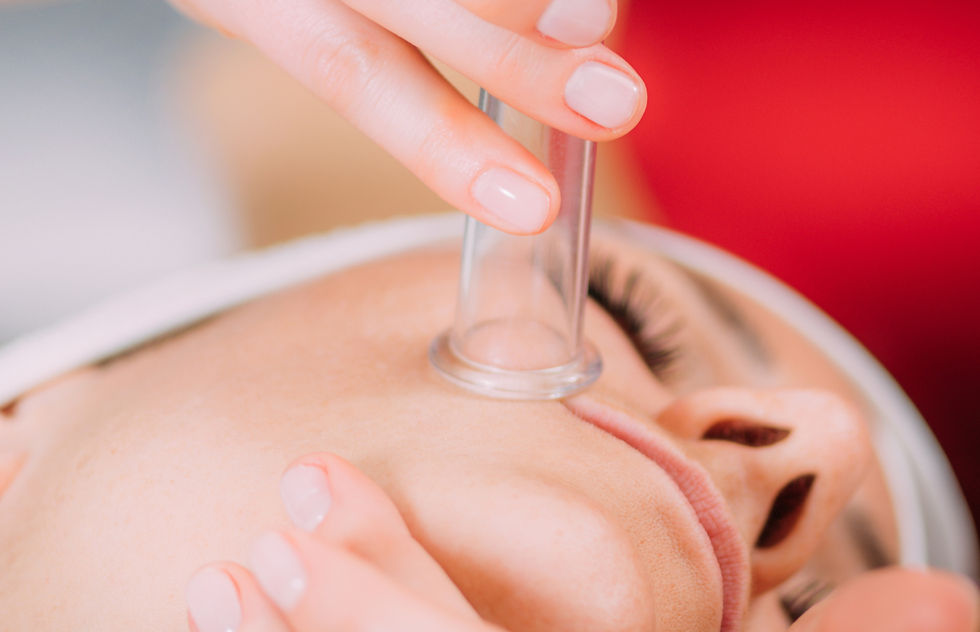 Face Cupping $22
