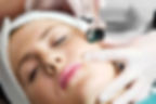 Skin Micro-Needling / Dermaroller