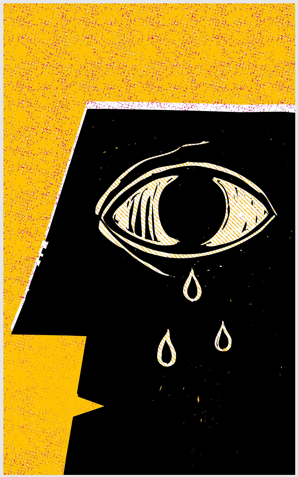 Eye Weeping