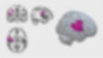 brain_fuchsia_edited.jpg