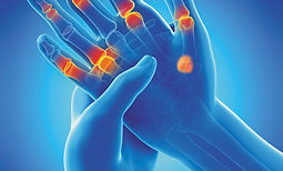 arthritis.jpg