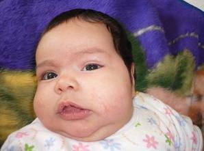 الطفل في الشهر من عمره ، رصد وقياس محيط رأسه لمتابعة نمو محيط الراس في الاشهر التالية والسنوا الاولى من عمره