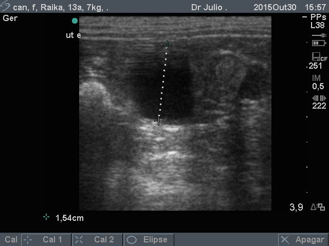 Infecção/Neoplasia Uterina