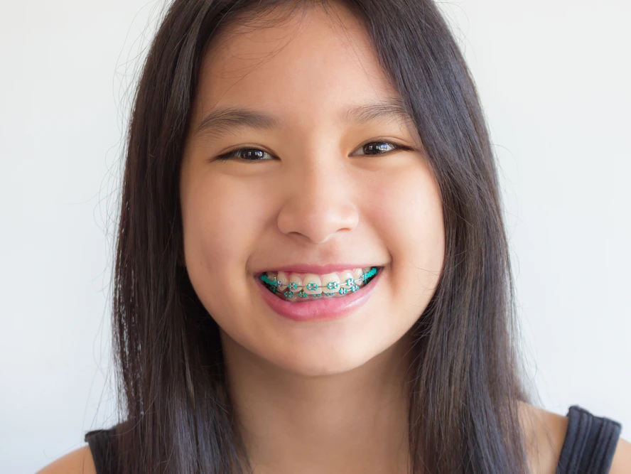 happy girl with braces