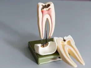 What Are The Symptoms of a Failed Root Canal? (And New Solutions)