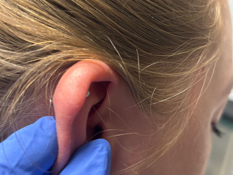 Hattest du schon mal Probleme mit einem Piercing?