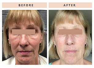 CoolPeel10167967401722.png