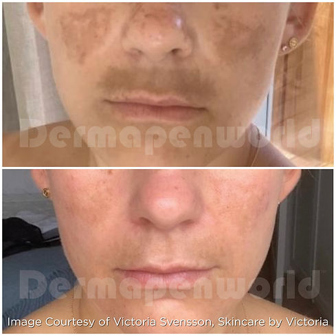 Pigmentation_Female 15.jpg